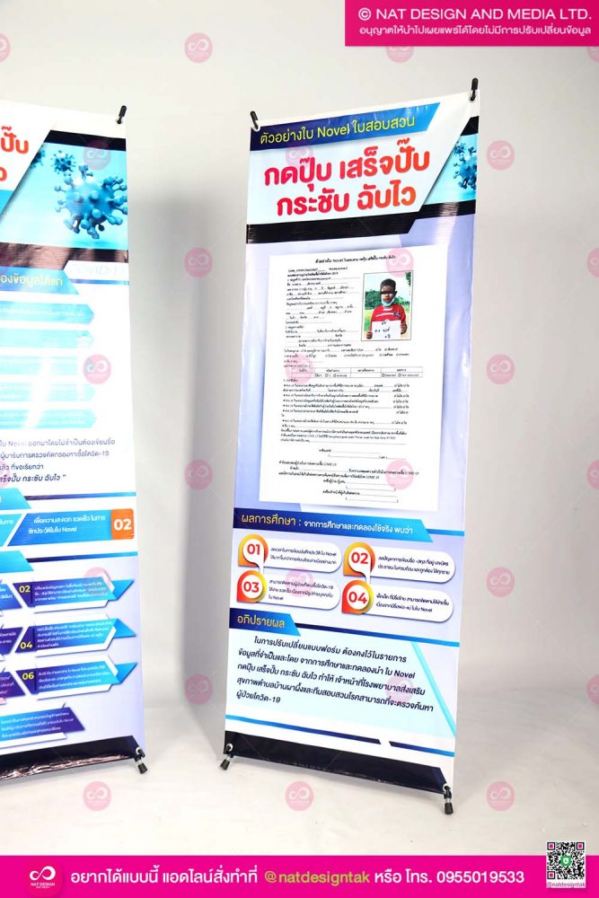 เอ็กสแตน